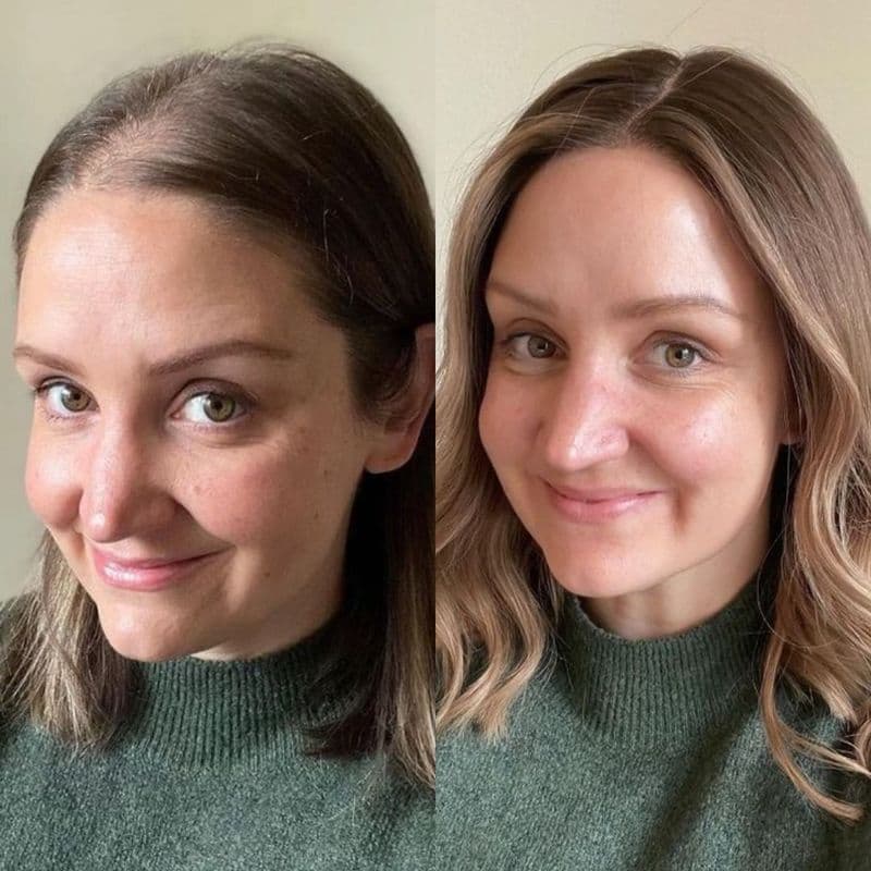 ShinyHair | Growth Kit - Image 8