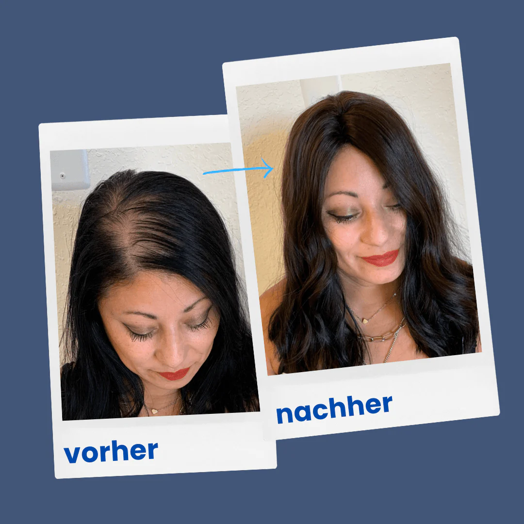 ShinyHair | Repair Kit - Image 5