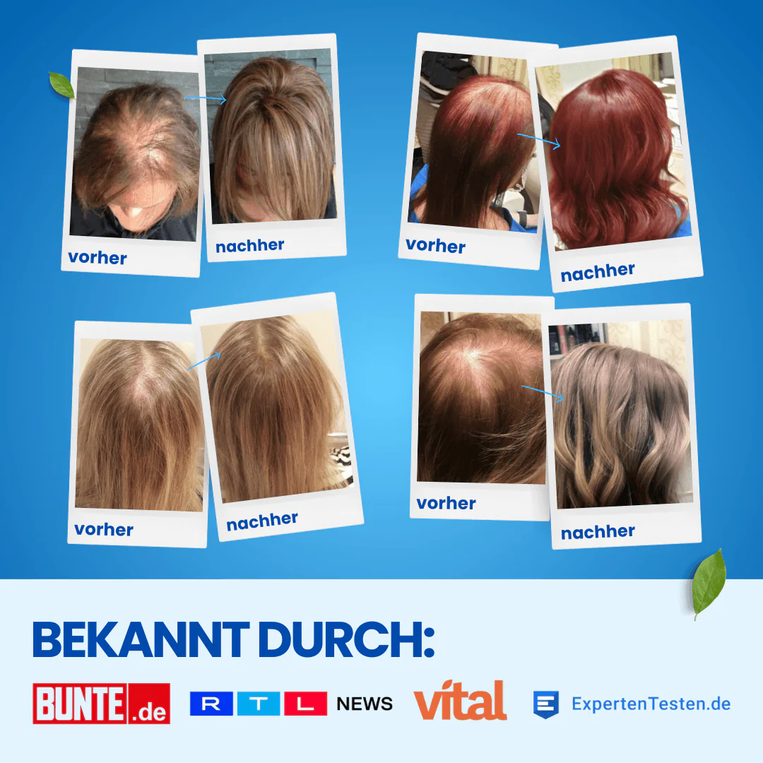 1x ShinyHair Haarwuchsbooster - Image 8
