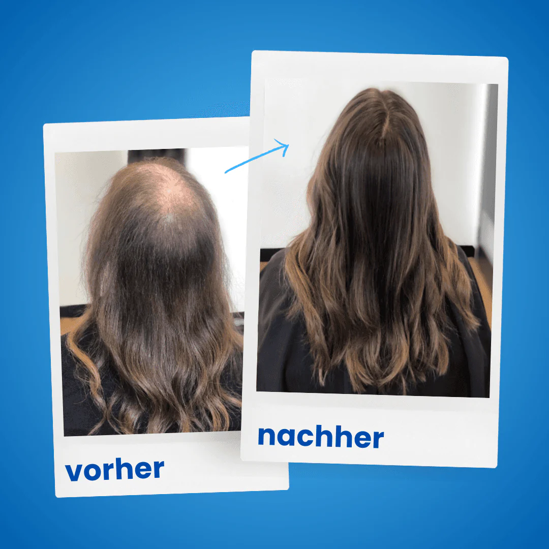 3x ShinyHair Haarwuchsbooster - Image 9
