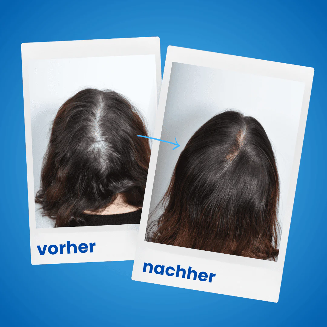 3x ShinyHair Haarwuchsbooster - Image 11