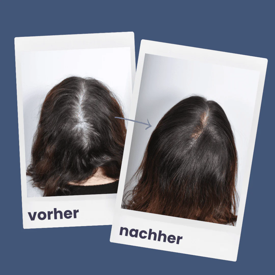 ShinyHair | Repair Kit - Image 6