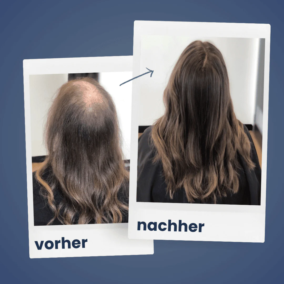 ShinyHair | Repair Kit - Image 22