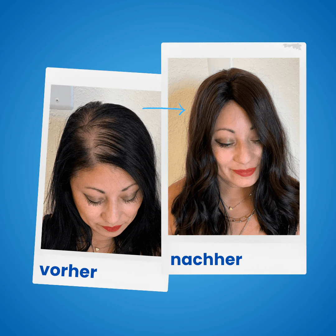 Yasmina Filali ShinyHair Bundle - Image 5